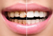 Diplomados con opción de titulación en la Facultad de Odontología de la UMSNH