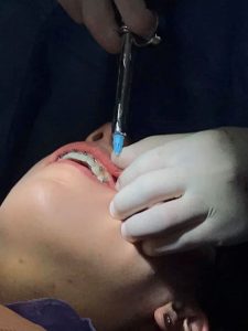 Convocatoria a especialidad en Endodoncia y Ortodoncia en el posgrado de odontología de la UMSNH