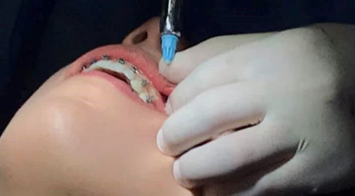 Ortodoncia y Endodoncia, la Facultad de Odontología de la UMSNH convoca a sus estudios de posgrado